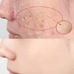 Peeling Gel For Face & Body - Image 5